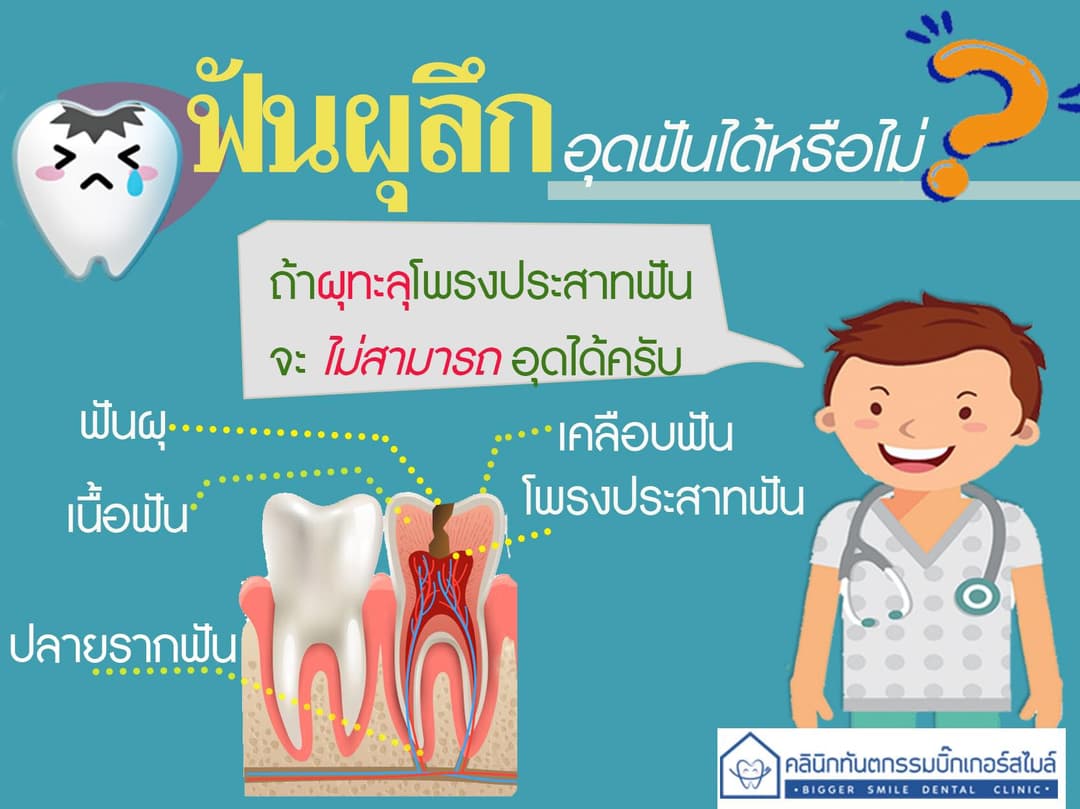 ฟันผุลึกอุดฟันได้หรือไม่