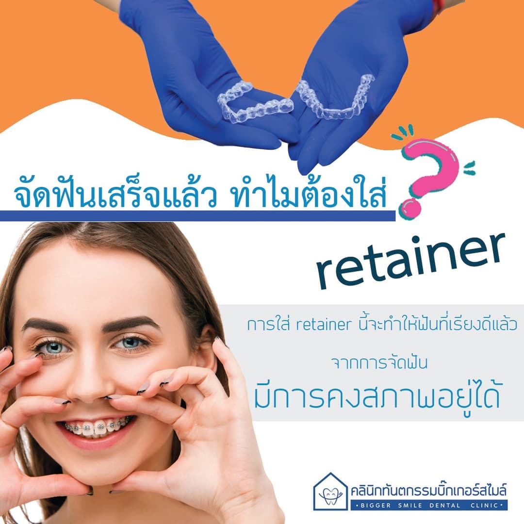 จัดฟันเสร็จแล้ว ทำไมต้องใส่ Retainer